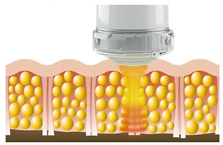 C-ACTOR